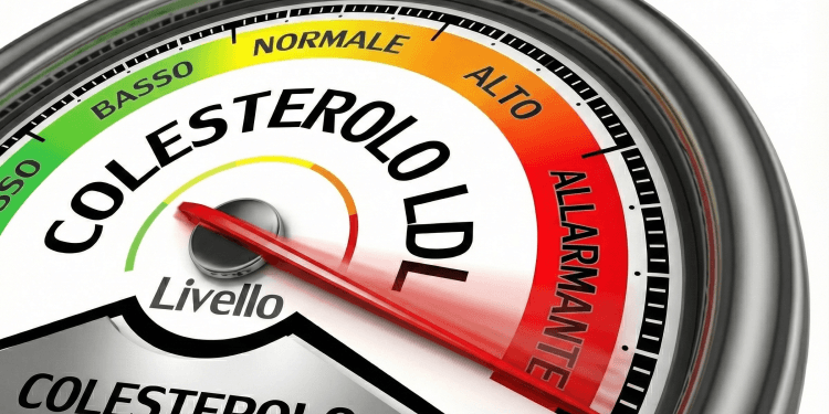 Un manometro indica un livello "Allarmante" di "Colesterolo Cattivo" (LDL). L'articolo esplora la notizia che una sola iniezione può abbassare il colesterolo LDL per tutta la vita.